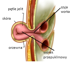 czesci przep